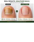 Nail Repair Oil by Noon Organics